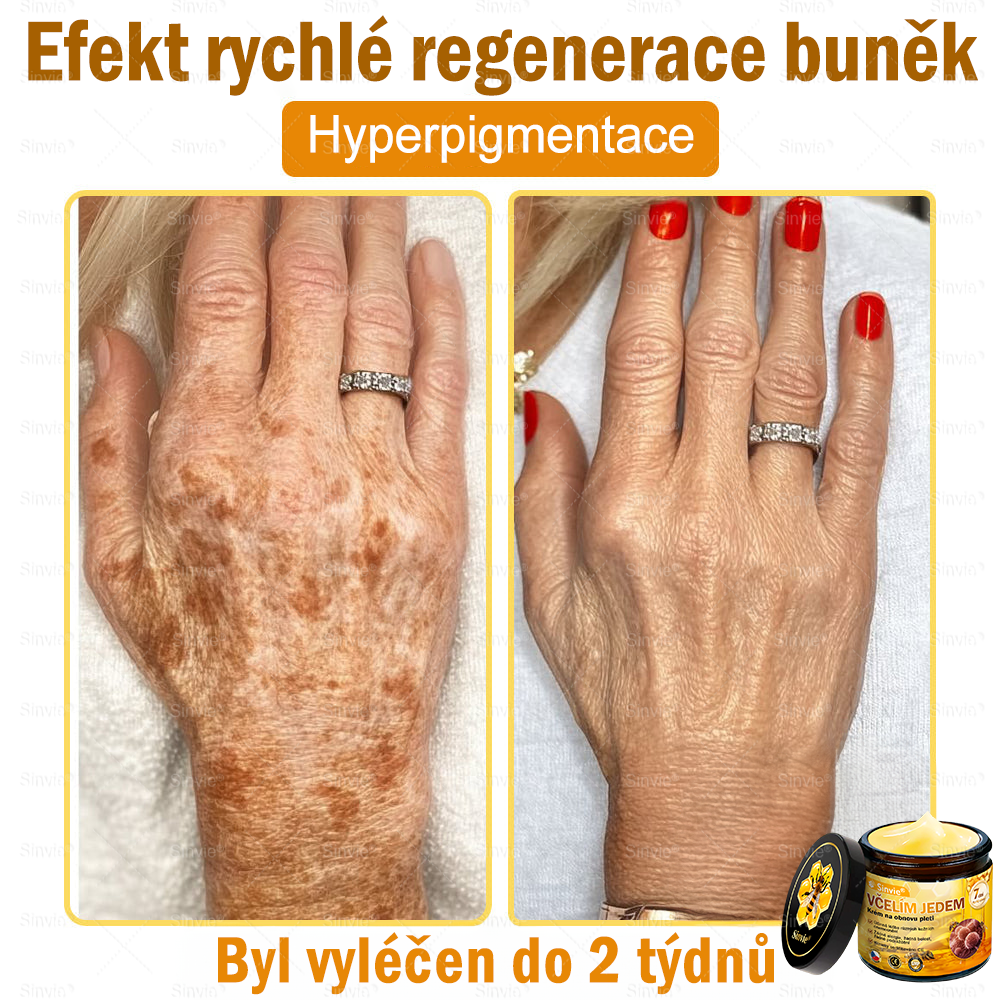 ✨Sinvie® Krém na obnovu pleti s včelím jedem | 50 ml | Doporučeno Českou dermatovenerologickou společností