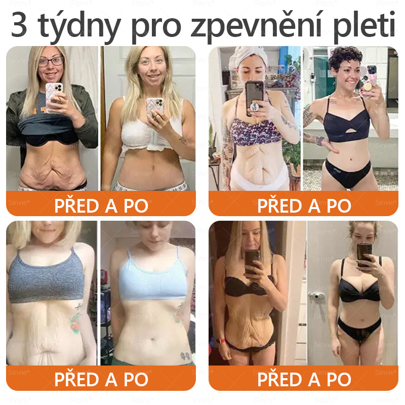 🎈Sinvie® Krém na obnovu pleti s včelím jedem | 50 ml | Doporučeno Českou dermatovenerologickou společností