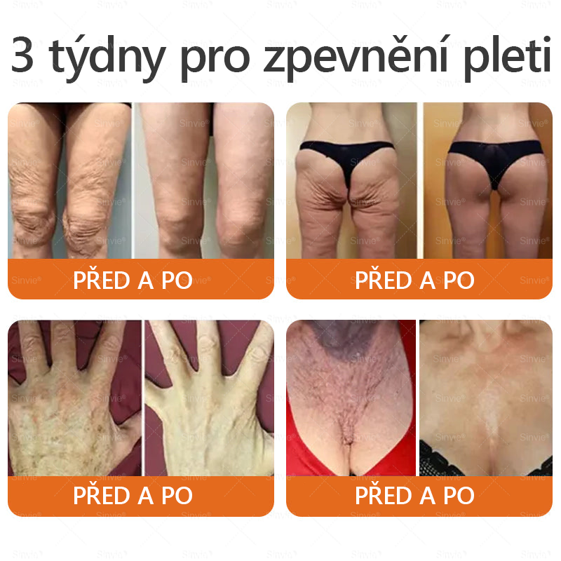 ✨Sinvie® Krém na obnovu pleti s včelím jedem | 50 ml | Doporučeno Českou dermatovenerologickou společností