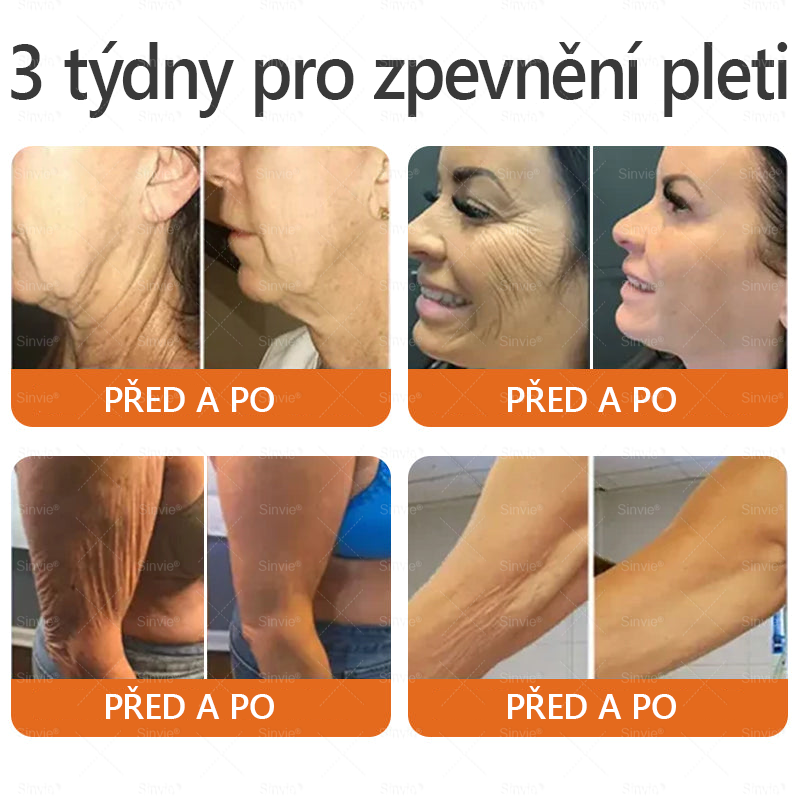 🎁 Zbývá pouze 5 boxů. Nabízíme vám extra 50% slevu! Udržujte si zdravou postavu. Pokud to teď propásnete, příští rok už nebude žádná šance.