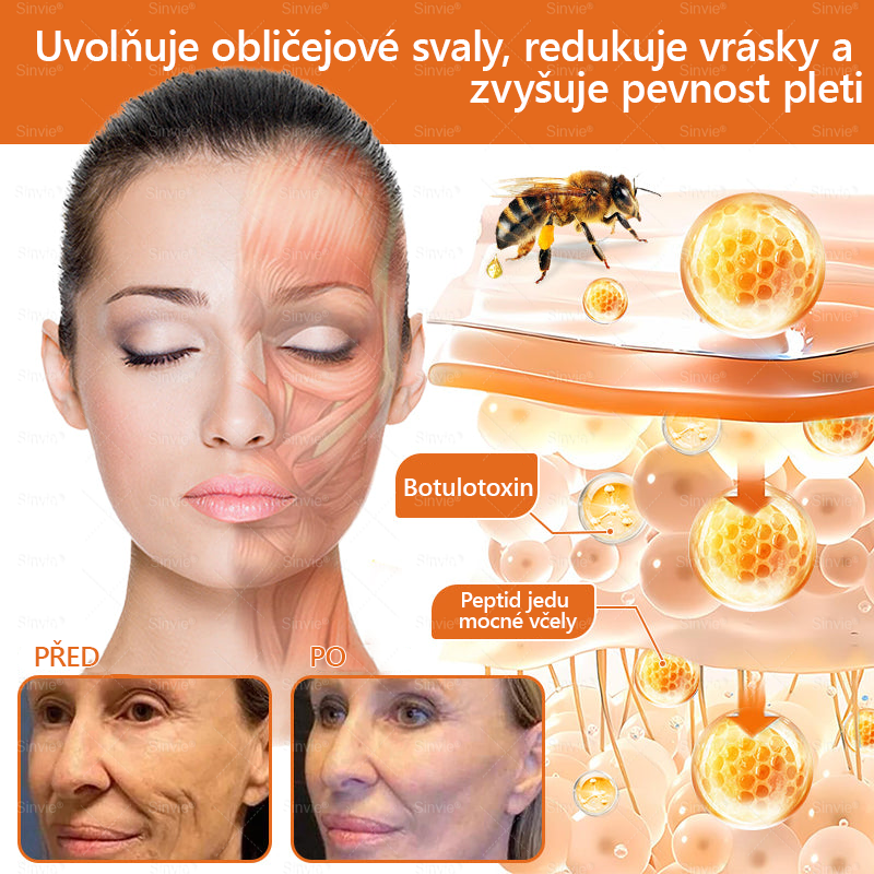 ❤️Sinvie® Krém na obnovu pleti s včelím jedem | 50 ml | Doporučeno Českou dermatovenerologickou společností