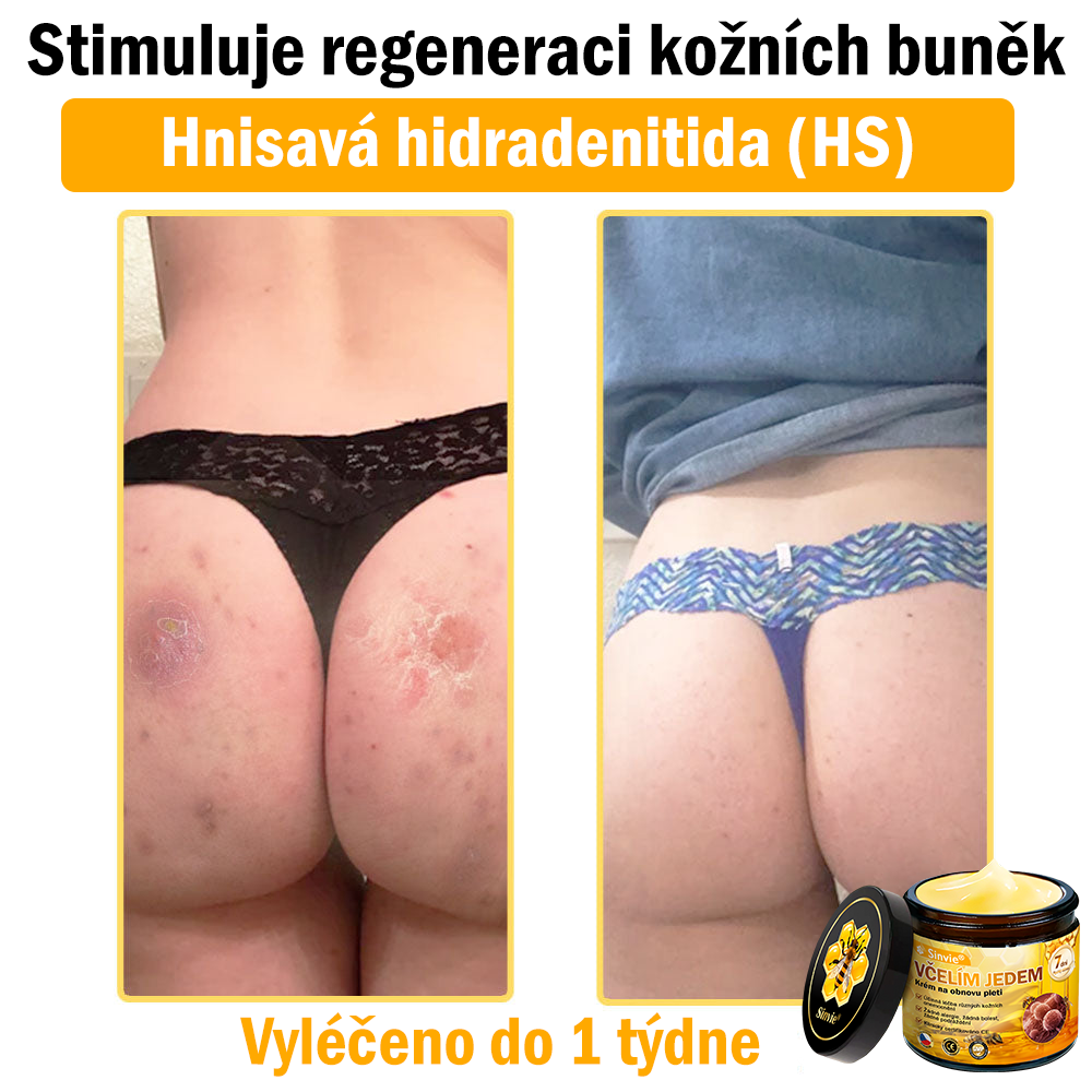 ✨Sinvie® Krém na obnovu pleti s včelím jedem | 50 ml | Doporučeno Českou dermatovenerologickou společností