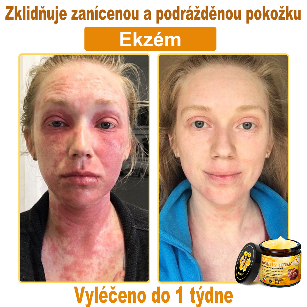 ✨Sinvie® Krém na obnovu pleti s včelím jedem | 50 ml | Doporučeno Českou dermatovenerologickou společností