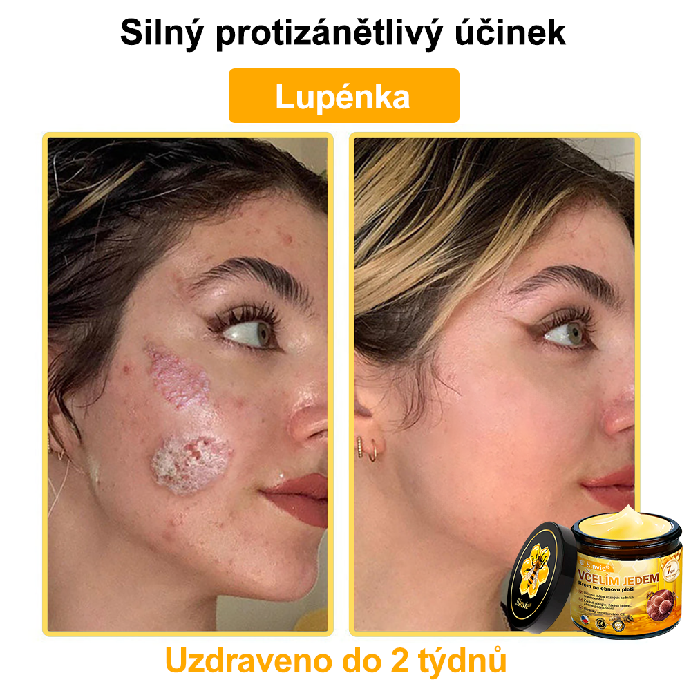 ✨Sinvie® Krém na obnovu pleti s včelím jedem | 50 ml | Doporučeno Českou dermatovenerologickou společností