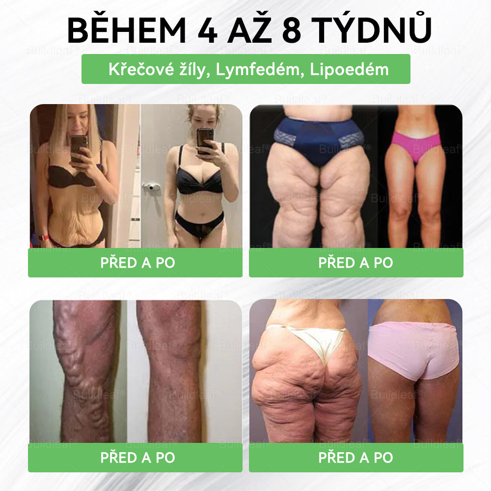 💖Oficiální obchod ČR | BuildLeaf® GLP-1 8-v-1 Fit & Vital Řešení (Jednou denně, viditelné změny za 7 dní) ✅ Obezita, kardiovaskulární zdraví, cukrovka, spánková apnoe, zdraví střev, problémy se klouby a další.