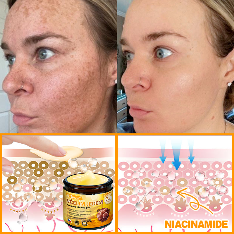 ✨Sinvie® Krém na obnovu pleti s včelím jedem | 50 ml | Doporučeno Českou dermatovenerologickou společností