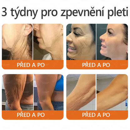 🎁 Zbývá pouze 5 boxů. Nabízíme vám extra 50% slevu! Udržujte si zdravou postavu. Pokud to teď propásnete, příští rok už nebude žádná šance.